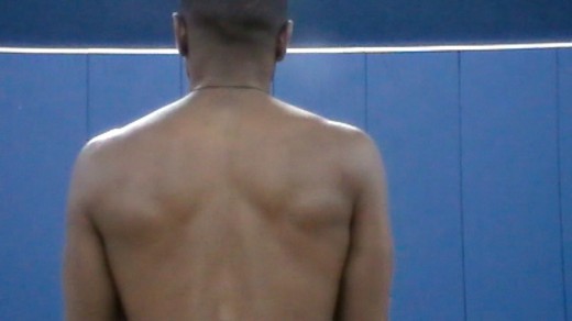 A picture of the scapulae in neutral position.