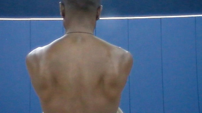 A picture of the position of the scaplae when there is minimal muscle tone in the back.