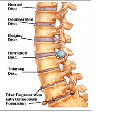The Spine